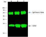 SOD2 Antibody in Immunoprecipitation (IP)