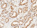 SULT1A1 Antibody in Immunohistochemistry (Paraffin) (IHC (P))