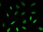 TLE1 Antibody in Immunocytochemistry (ICC/IF)