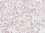 TLE1 Antibody in Immunohistochemistry (Paraffin) (IHC (P))