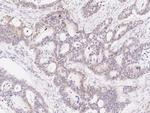 TLE1 Antibody in Immunohistochemistry (Paraffin) (IHC (P))