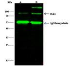 TLK1 Antibody in Immunoprecipitation (IP)