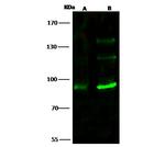 TLK1 Antibody in Western Blot (WB)