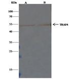 TRAF4 Antibody in Immunoprecipitation (IP)