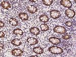 Thioredoxin 2 Antibody in Immunohistochemistry (Paraffin) (IHC (P))