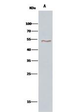 VRK1 Antibody in Immunoprecipitation (IP)