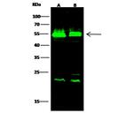 VRK1 Antibody in Western Blot (WB)