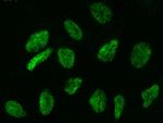 WDR77 Antibody in Immunocytochemistry (ICC/IF)