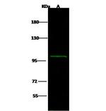 beta-1 Adaptin Antibody in Western Blot (WB)