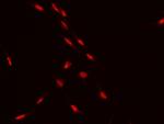 ATF Antibody in Immunocytochemistry (ICC/IF)