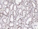 PRMT4 Antibody in Immunohistochemistry (Paraffin) (IHC (P))