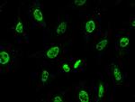 CHD4 Antibody in Immunocytochemistry (ICC/IF)