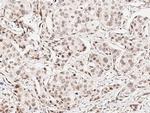 CHD4 Antibody in Immunohistochemistry (Paraffin) (IHC (P))