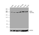 CHD4 Antibody in Western Blot (WB)