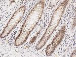 VDR Antibody in Immunohistochemistry (Paraffin) (IHC (P))