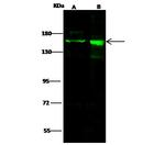 Drosha Antibody in Western Blot (WB)