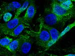 GDF5 Antibody in Immunocytochemistry (ICC/IF)