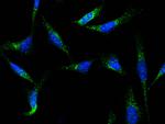 CD18 Antibody in Immunocytochemistry (ICC/IF)