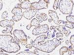 CD104 Antibody in Immunohistochemistry (Paraffin) (IHC (P))