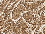 MEK5 Antibody in Immunohistochemistry (Paraffin) (IHC (P))