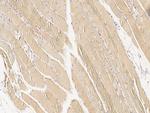 MEK5 Antibody in Immunohistochemistry (Paraffin) (IHC (P))