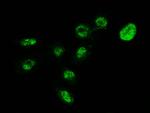 MECP2 Antibody in Immunocytochemistry (ICC/IF)