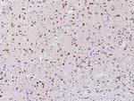 MECP2 Antibody in Immunohistochemistry (Paraffin) (IHC (P))