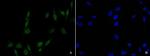 MiTF Antibody in Immunocytochemistry (ICC/IF)