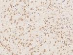 MSI1 Antibody in Immunohistochemistry (Paraffin) (IHC (P))