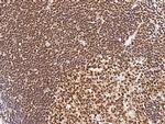 Myb Antibody in Immunohistochemistry (Paraffin) (IHC (P))