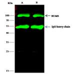 NUMB Antibody in Immunoprecipitation (IP)