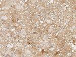 SMAD7 Antibody in Immunohistochemistry (Paraffin) (IHC (P))