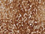 SMAD7 Antibody in Immunohistochemistry (Paraffin) (IHC (P))