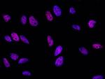 SOX11 Antibody in Immunocytochemistry (ICC/IF)