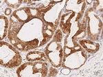 TNRC6A Antibody in Immunohistochemistry (Paraffin) (IHC (P))