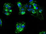 CPT2 Antibody in Immunocytochemistry (ICC/IF)