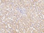 CPT2 Antibody in Immunohistochemistry (Paraffin) (IHC (P))