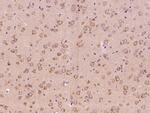 Neuropilin 1 Antibody in Immunohistochemistry (Paraffin) (IHC (P))