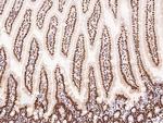 PTBP1 Antibody in Immunohistochemistry (Paraffin) (IHC (P))