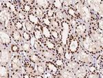 PTBP1 Antibody in Immunohistochemistry (Paraffin) (IHC (P))