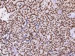 PTBP1 Antibody in Immunohistochemistry (Paraffin) (IHC (P))