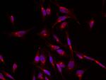 GLUT4 Antibody in Immunocytochemistry (ICC/IF)