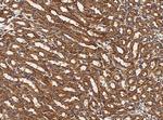 alanyl-tRNA Synthetase Antibody in Immunohistochemistry (Paraffin) (IHC (P))