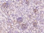 Serum Amyloid P Antibody in Immunohistochemistry (Paraffin) (IHC (P))