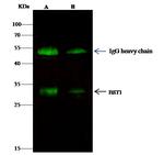 BST-1 Antibody in Immunoprecipitation (IP)