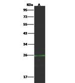 CD70 Antibody in Western Blot (WB)