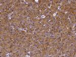 CEL Antibody in Immunohistochemistry (Paraffin) (IHC (P))