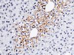 E-cadherin Antibody in Immunohistochemistry (Paraffin) (IHC (P))