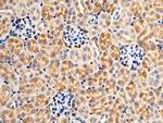 Growth Hormone Receptor Antibody in Immunohistochemistry (Paraffin) (IHC (P))