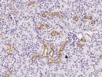 IGFBP2 Antibody in Immunohistochemistry (Paraffin) (IHC (P))